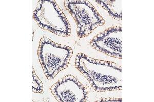 Immunohistochemical analysis of paraffin-embedded human small intestine tissue using (ABIN656646 and ABIN2845888) performed on the Leica® BOND RXm. (SLC23A1 antibody  (N-Term))