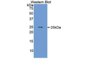 Detection of Recombinant GH, Mouse using Polyclonal Antibody to Growth Hormone (GH) (Growth Hormone 1 antibody  (AA 28-216))