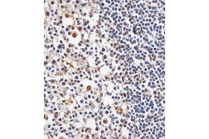 (ABIN6244013 and ABIN6578740) staining TAF4 in human tonsil tissue sections by Immunohistochemistry (IHC-P - paraformaldehyde-fixed, paraffin-embedded sections). (TAF4 antibody  (AA 1021-1062))