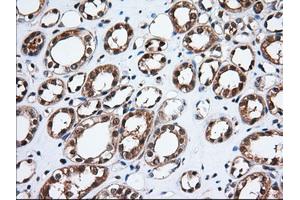 Immunohistochemical staining of paraffin-embedded Human Kidney tissue using anti-TBXAS1 mouse monoclonal antibody. (TBXAS1 antibody)