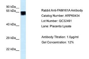 Western Blotting (WB) image for anti-Family with Sequence Similarity 161, Member A (FAM161A) (C-Term) antibody (ABIN2788447) (FAM161A antibody  (C-Term))