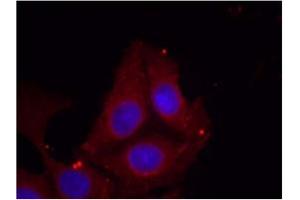 Image no. 1 for anti-Growth Associated Protein 43 (GAP43) (pSer41) antibody (ABIN401573) (GAP43 antibody  (pSer41))