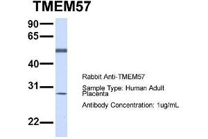 Host:  Rabbit  Target Name:  TMEM57  Sample Type:  Human Adult Placenta  Antibody Dilution:  1. (TMEM57 antibody  (N-Term))