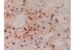 Used in DAB staining on fromalin fixed paraffin- embedded liver tissue (Azurocidin antibody  (AA 23-247))