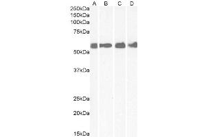 ABIN238557 (1µg/ml) staining of Human Colon (A), Cerebellum (B), Rat Brain (C) and Mouse spinal Cord (D) lysates (35µg protein in RIPA buffer). (CRHR1 antibody  (AA 107-117))