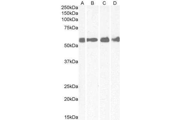 CRHR1 anticorps  (AA 107-117)