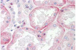 Image no. 2 for anti-Solute Carrier Family 22 Member 6 (SLC22A6) (C-Term) antibody (ABIN6749721) (SLC22A6 antibody  (C-Term))