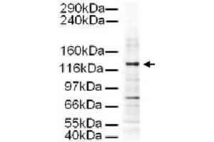 Western blot using AP3D1 polyclonal antibody  shows detection of a 130 KDa band corresponding to Human AP3D1 in a HeLa whole cell lysate. (AP3D1 antibody  (AA 686-698))
