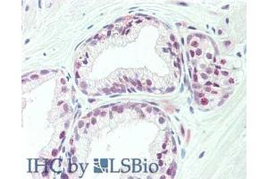 Immunohistochemistry of rabbit anti-TAF1 antibody. (TAF1 antibody  (C-Term))