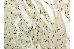 Immunohistochemistry (Paraffin-embedded Sections) (IHC (p)) image for anti-Nuclear Receptor Subfamily 3, Group C, Member 1 (Glucocorticoid Receptor) (NR3C1) (AA 20-199) antibody (ABIN3043371)