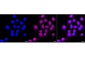 Immunocytochemical staining of HT- cells with Casein kinase 2 alpha 1 antibody (ABIN7797882), 1:1,000).