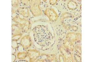 Immunohistochemistry of paraffin-embedded human kidney tissue using ABIN7170910 at dilution of 1:100 (SUCLA2 antibody  (AA 1-180))