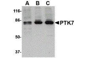 Western Blotting (WB) image for anti-PTK7 Protein tyrosine Kinase 7 (PTK7) (N-Term) antibody (ABIN2476280) (PTK7 antibody  (N-Term))