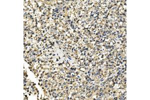 IHC analysis of Hexokinase 1/HK1 using anti-Hexokinase 1/HK1 antibody (ABIN7600258).