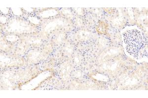 Detection of AhR in Human Kidney Tissue using Polyclonal Antibody to Aryl Hydrocarbon Receptor (AhR) (Aryl Hydrocarbon Receptor antibody  (AA 128-399))