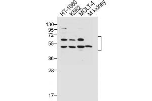All lanes : Anti-WT1 Antibody (Center ) at 1:1000 dilution Lane 1: HT-1080 whole cell lysate Lane 2: K562 whole cell lysate Lane 3: MOLT-4 whole cell lysate Lane 4: Mouse kidney lysate Lysates/proteins at 20 μg per lane. (WT1 antibody  (AA 346-375))