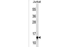 RPS23 Antibody (N-term) (ABIN1538877 and ABIN2850072) western blot analysis in Jurkat cell line lysates (35 μg/lane). (RPS23 antibody  (N-Term))