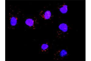 Proximity Ligation Analysis of protein-protein interactions between GAB1 and SOS1.