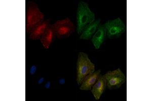 ABIN6261372 and ABIN6279351 staining  cells by IF/ICC. (Desmoglein 3 antibody  (C-Term))