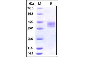 Mouse PD-L2, His Tag on SDS-PAGE under reducing (R) condition. (PDCD1LG2 Protein (AA 20-219) (His tag))