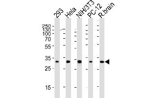 Western blot analysis of lysates from 293, Hela, mouse NIH/3T3, rat PC-12 cell line and rat brain tissue lysate(from left to right), using RPS6 Antibody (N-term) (ABIN6242615 and ABIN6577071). (RPS6 antibody)