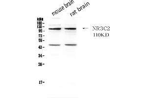 Western blot analysis of NR3C2 using anti- NR3C2 antibody .