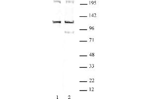 TRIM37 antibody (pAb) tested by Western blot. (TRIM37 antibody  (C-Term))