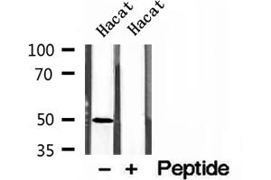 Western blot analysis of extracts of Hacat cells, using AP1M1 antibody. (AP1M1 antibody  (Internal Region))