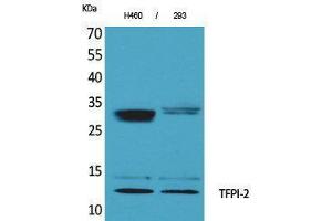 Western Blotting (WB) image for anti-Tissue Factor Pathway Inhibitor 2 (TFPI2) (C-Term) antibody (ABIN3187702) (TFPI2 antibody  (C-Term))