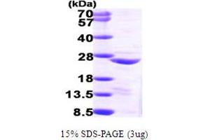 SDS-PAGE (SDS) image for Copper Metabolism (Murr1) Domain Containing 1 (COMMD1) (AA 1-190) protein (His tag) (ABIN667798) (COMMD1 Protein (AA 1-190) (His tag))