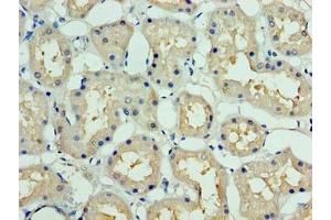 Immunohistochemistry of paraffin-embedded human kidney tissue using ABIN7149509 at dilution of 1:100 (DCUN1D1 antibody  (AA 1-259))