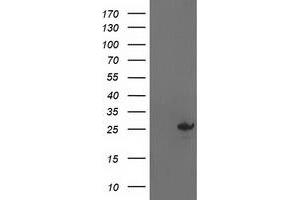 Western Blotting (WB) image for anti-Adenylate Kinase 4 (AK4) antibody (ABIN1496526)