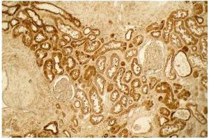 Immunohistochemistry (IHC) image for anti-COL1A2/COL1A1 antibody (ABIN5596819)