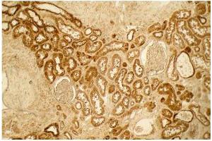 Immunohistochemistry (IHC) image for anti-Collagen, Type I (COL1) antibody (ABIN5596819)