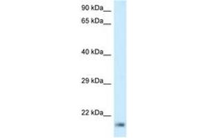 Image no. 1 for anti-Ribosomal Protein L23A (RPL23A) (C-Term) antibody (ABIN6747503) (RPL23A antibody  (C-Term))