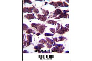 LRIG2 Antibody immunohistochemistry analysis in formalin fixed and paraffin embedded human skeletal muscle followed by peroxidase conjugation of the secondary antibody and DAB staining. (LRIG2 antibody  (C-Term))