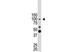 Image no. 1 for anti-Prospero Homeobox 1 (PROX1) (N-Term) antibody (ABIN357416) (PROX1 antibody  (N-Term))