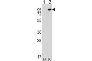 Western blot analysis of WHSC1L1 (arrow) using rabbit polyclonal WHSC1L1 Antibody (N-term) . (WHSC1L1 antibody  (N-Term))