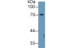 WB of Protein Standard: different control antibodies against Highly purified E. (Angiopoietin 2 CLIA Kit)