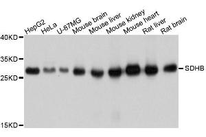 Western blot analysis of extracts of various cell lines, using SDHB antibody. (SDHB antibody  (AA 29-280))