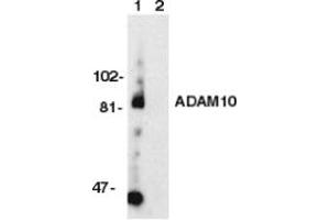 Image no. 1 for anti-ADAM Metallopeptidase Domain 10 (ADAM10) (AA 732-748) antibody (ABIN201912) (ADAM10 antibody  (AA 732-748))
