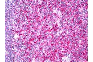 Anti-CD81 antibody IHC of human tonsil, germinal center. (CD81 antibody)