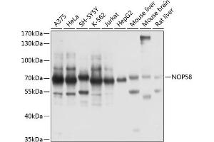 Western blot analysis of extracts of various cell lines, using NOP58 antibody  at 1:1000 dilution. (NOP58 antibody  (AA 360-529))