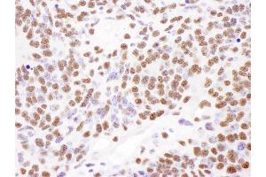 Immunohistochemistry (IHC) image for anti-Poly A Binding Protein Nuclear 1 (PABPN1) (AA 1-50) antibody (ABIN7454922)