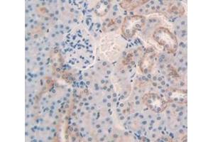 Figure. (VNN1 antibody  (AA 390-503))