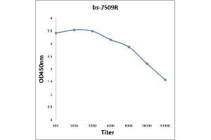 Antigen: 0. (AGGF1 antibody  (AA 461-560))