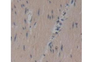 IHC-P analysis of Human Tissue, with DAB staining. (CCDC80 antibody  (AA 635-906))