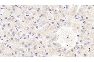 Detection of SIRT3 in Human Liver Tissue using Monoclonal Antibody to Sirtuin 3 (SIRT3) (SIRT3 antibody  (AA 126-399))