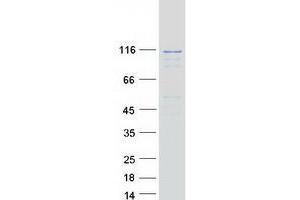 Validation with Western Blot (EFTUD2 Protein (Transcript Variant 1) (Myc-DYKDDDDK Tag))