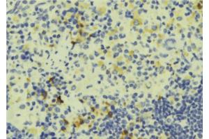 ABIN6274227 at 1/100 staining Human lymph tissue by IHC-P.